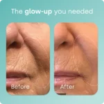 Biosil Collagen Generator - Liquid Capsules. This science-backed formula supports smoother skin, stronger nails, and fuller, shinier hair, It contains ch-OSA, one of the most studied bioavailable forms of silicon. - Image 4